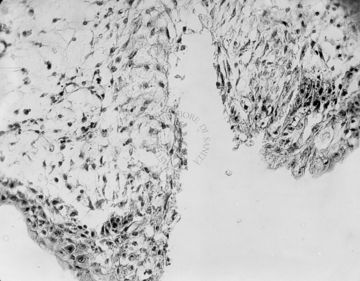 Embrioni inoculati con materiale leucemico umano con e senza filtrazioni da Scitz. Controlli relativi