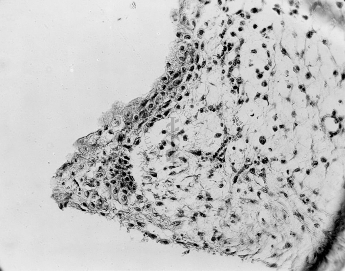 Embrioni inoculati con materiale leucemico umano con e senza filtrazioni da Scitz. Controlli relativi