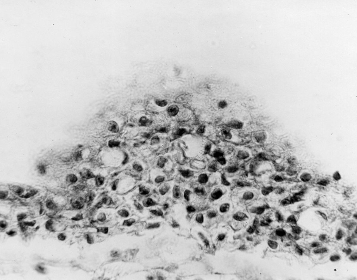 Embrioni inoculati con materiale leucemico umano con e senza filtrazioni da Scitz. Controlli relativi