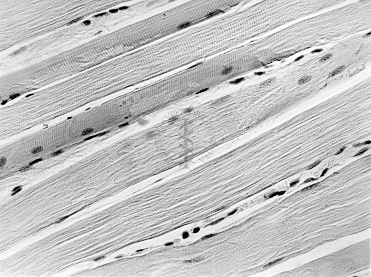 Effetto dell'ipertiroidismo sperimentale sulle alterazioni muscolari da avitaminosi nel ratto