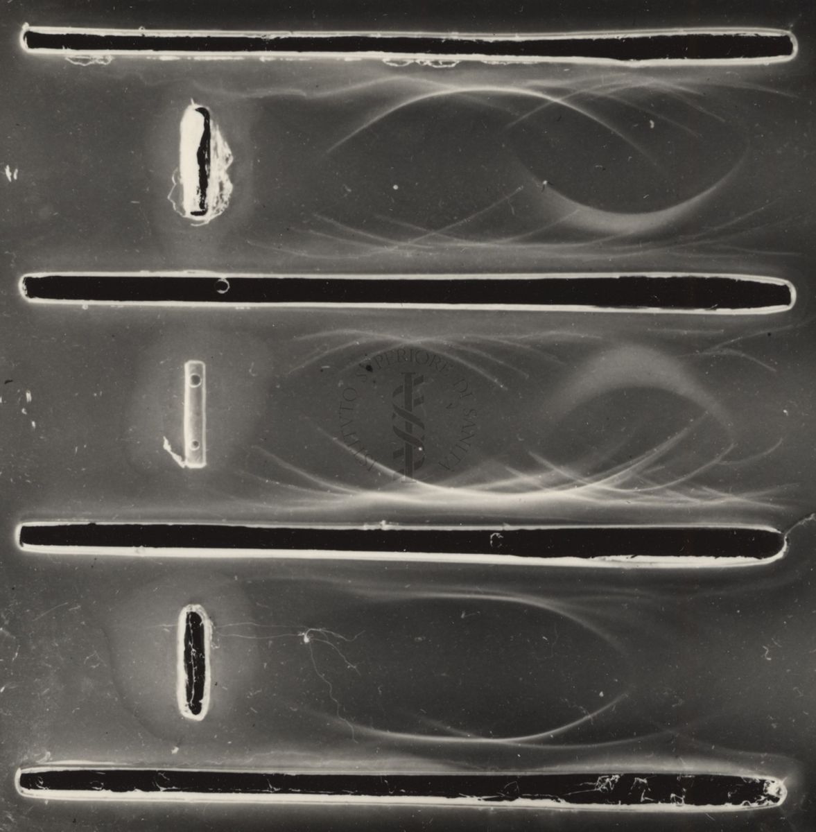 Immunoelettroforesi di tubercolare