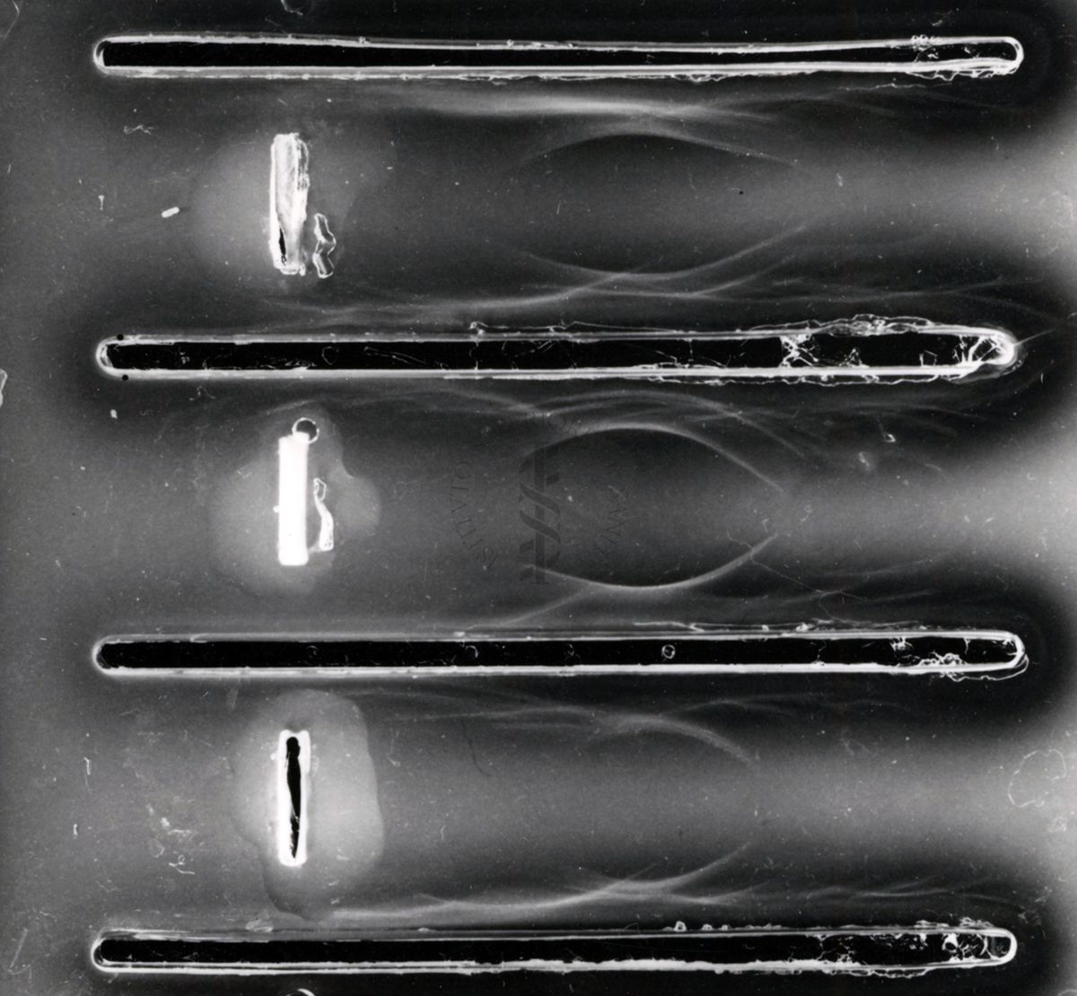 Immunoelettroforesi di tubercolare