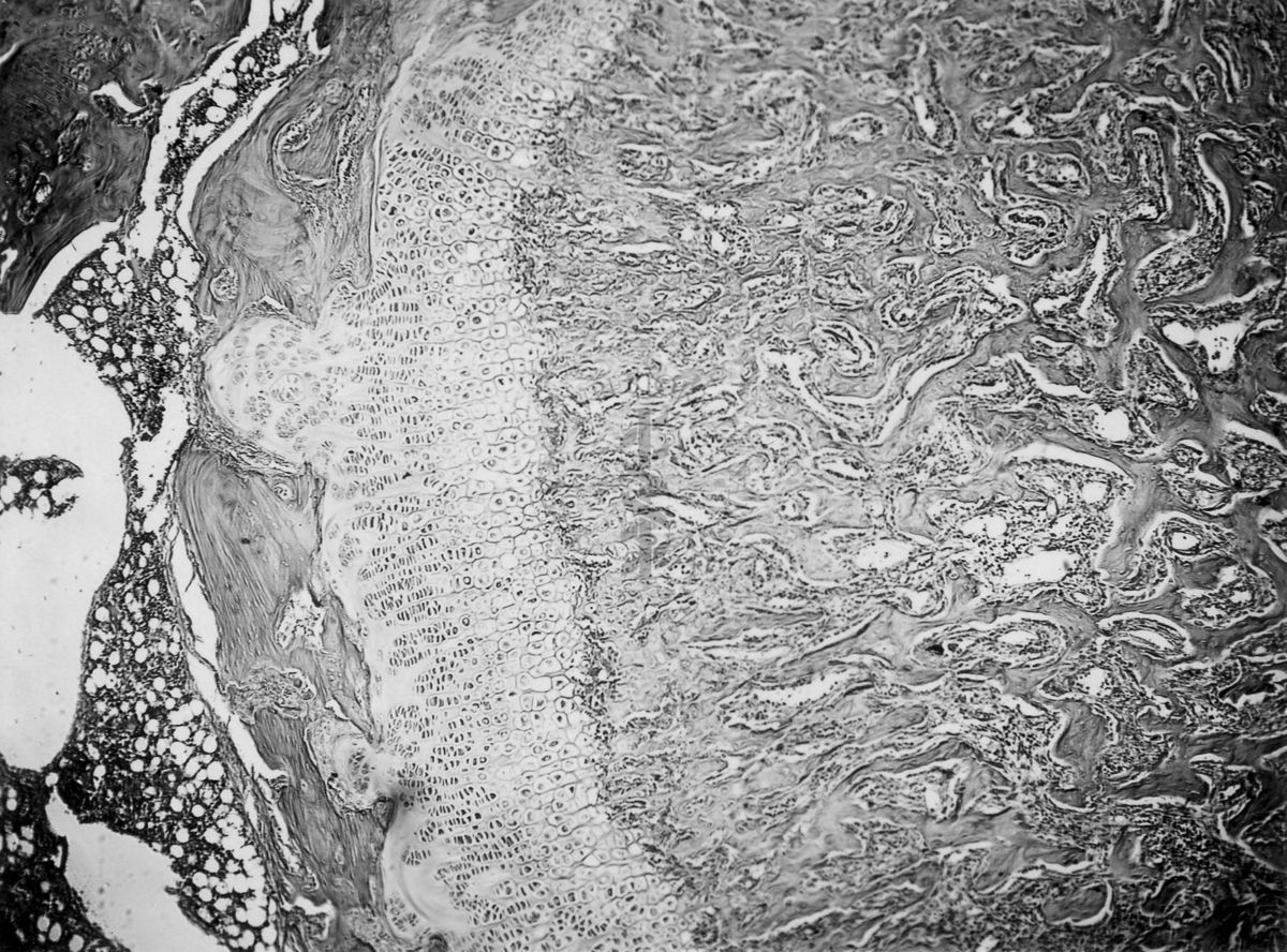 Azione degli ormoni somatotropo ed androgeno sulla cartilagine