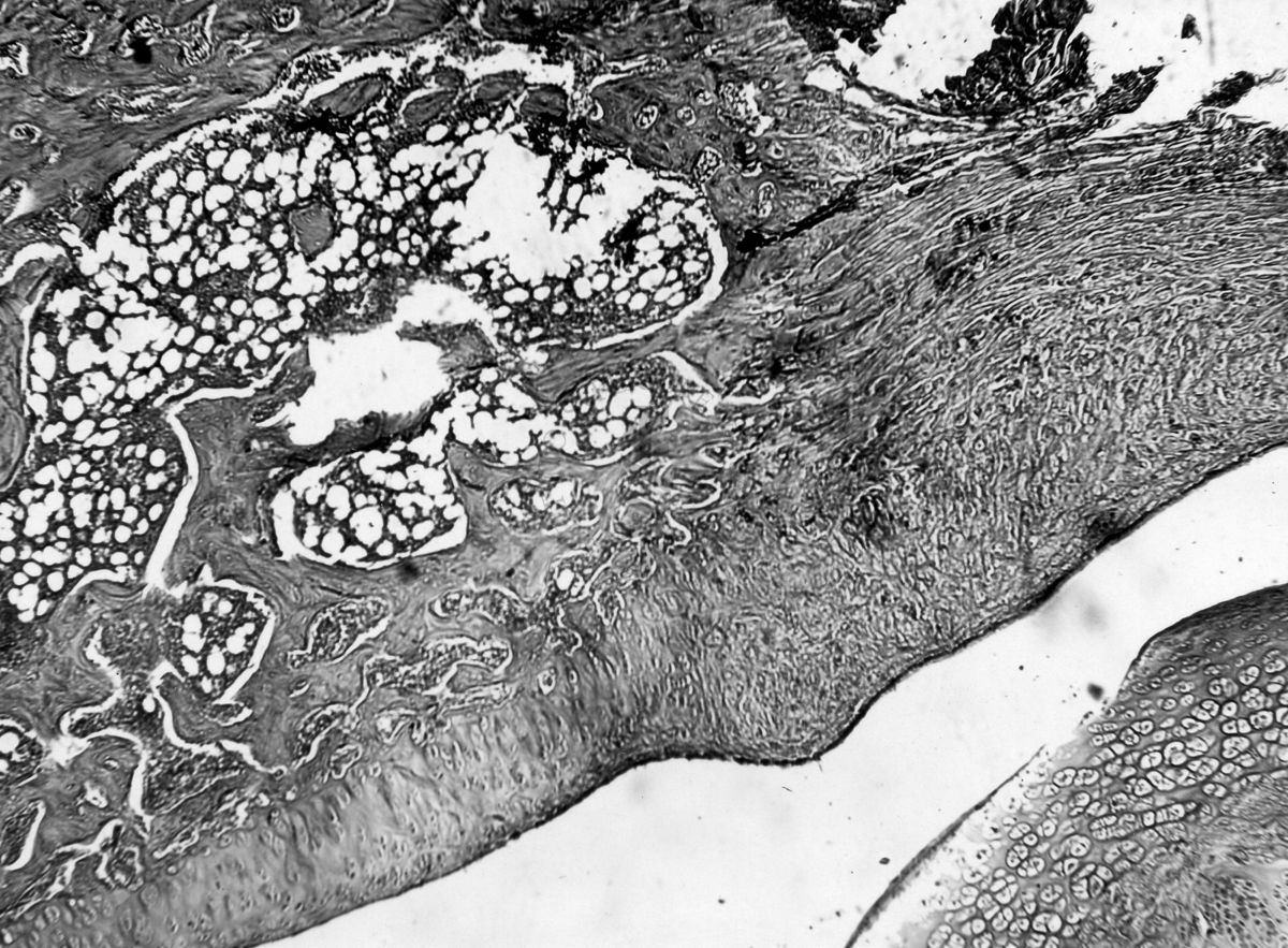 Azione degli ormoni somatotropo ed androgeno sulla cartilagine