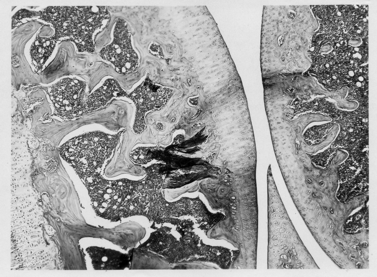 Azione degli ormoni somatotropo ed androgeno sulla cartilagine