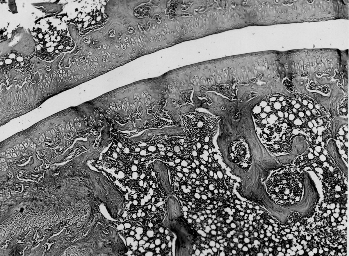 Azione degli ormoni somatotropo ed androgeno sulla cartilagine