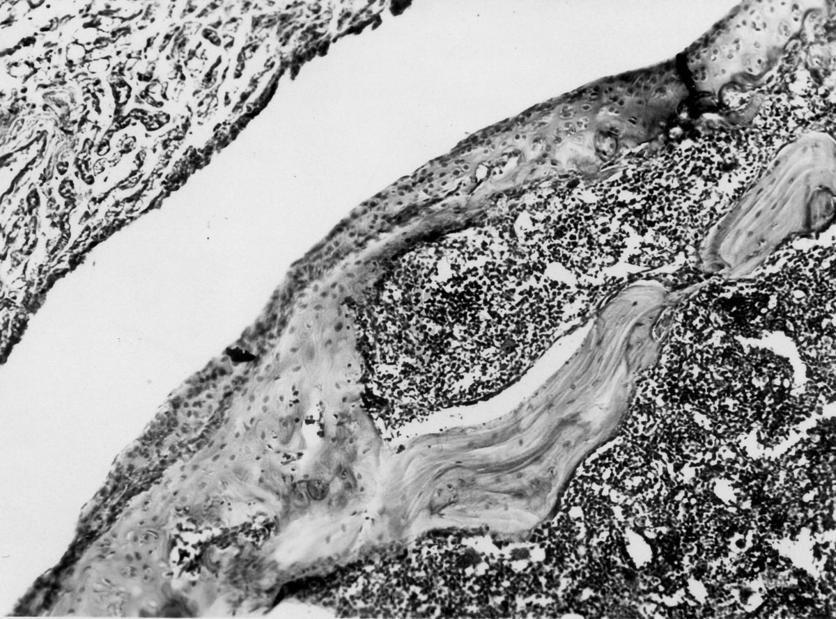 Azione degli ormoni somatotropo ed androgeno sulla cartilagine