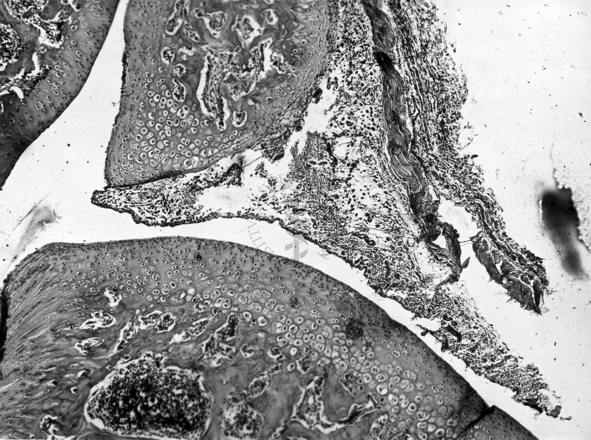 Azione degli ormoni somatotropo ed androgeno sulla cartilagine