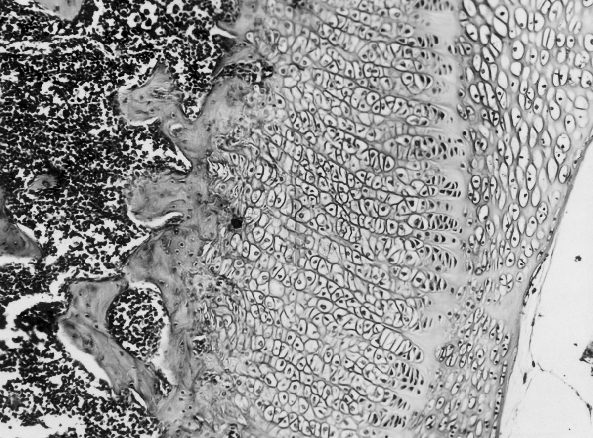 Azione degli ormoni somatotropo ed androgeno sulla cartilagine