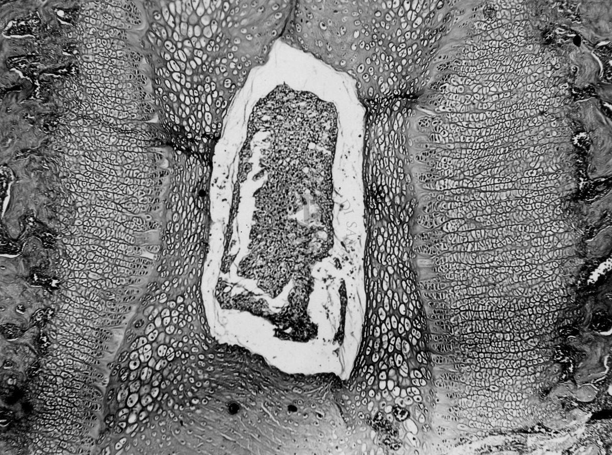 Azione degli ormoni somatotropo ed androgeno sulla cartilagine