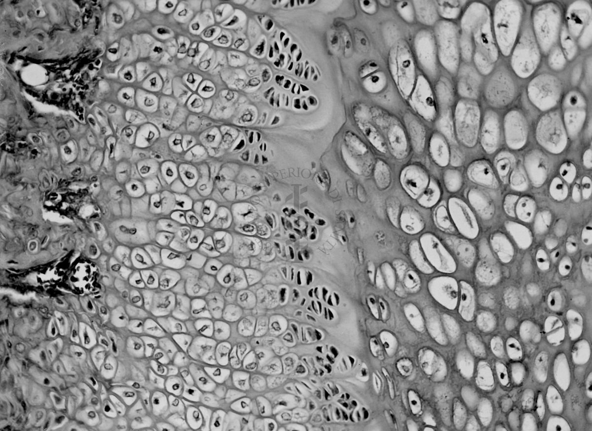 Azione degli ormoni somatotropo ed androgeno sulla cartilagine