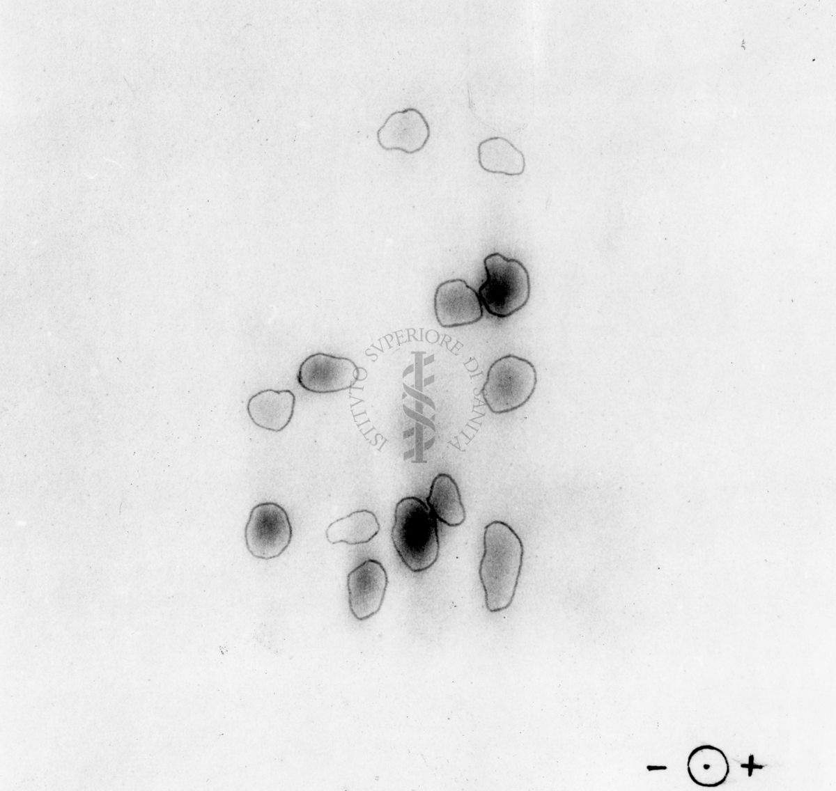 Montaggio di gel cromatografico su carta