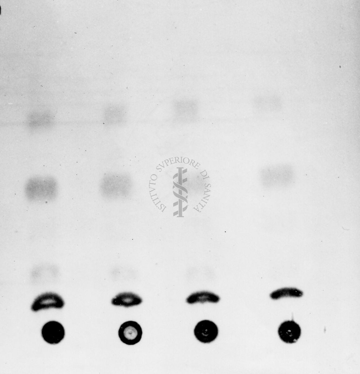 Montaggio di gel cromatografico su carta