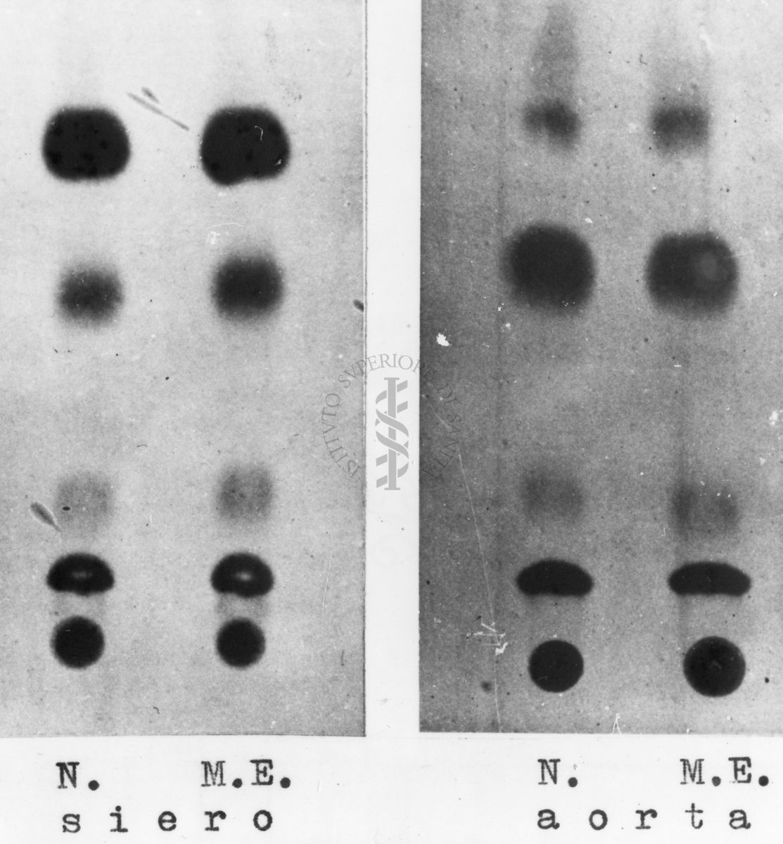 Montaggio di gel cromatografico su carta