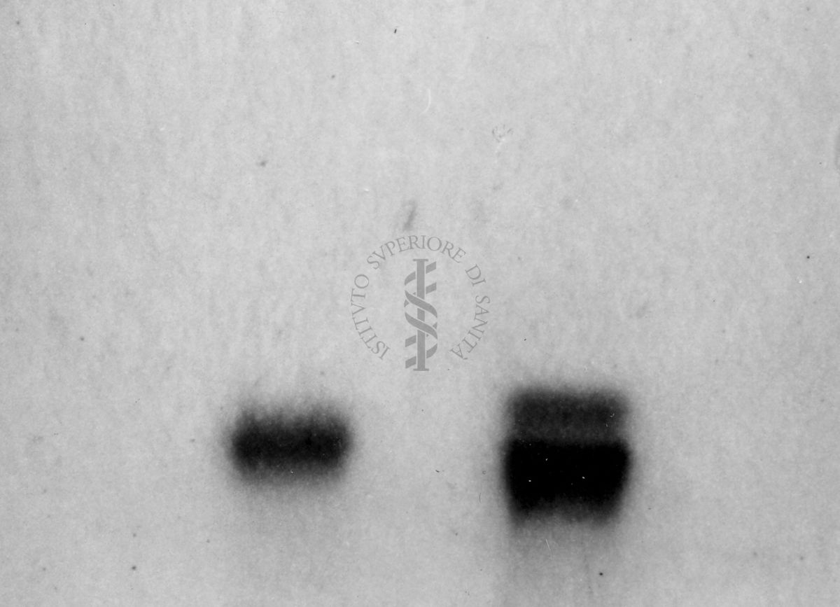 Montaggio di gel cromatografico su carta