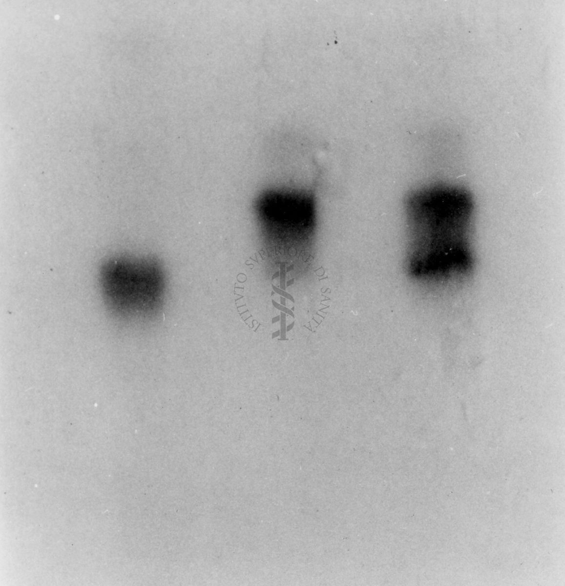 Montaggio di gel cromatografico su carta