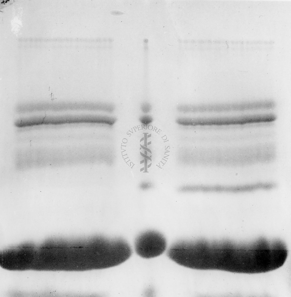 Montaggio di gel cromatografico su carta