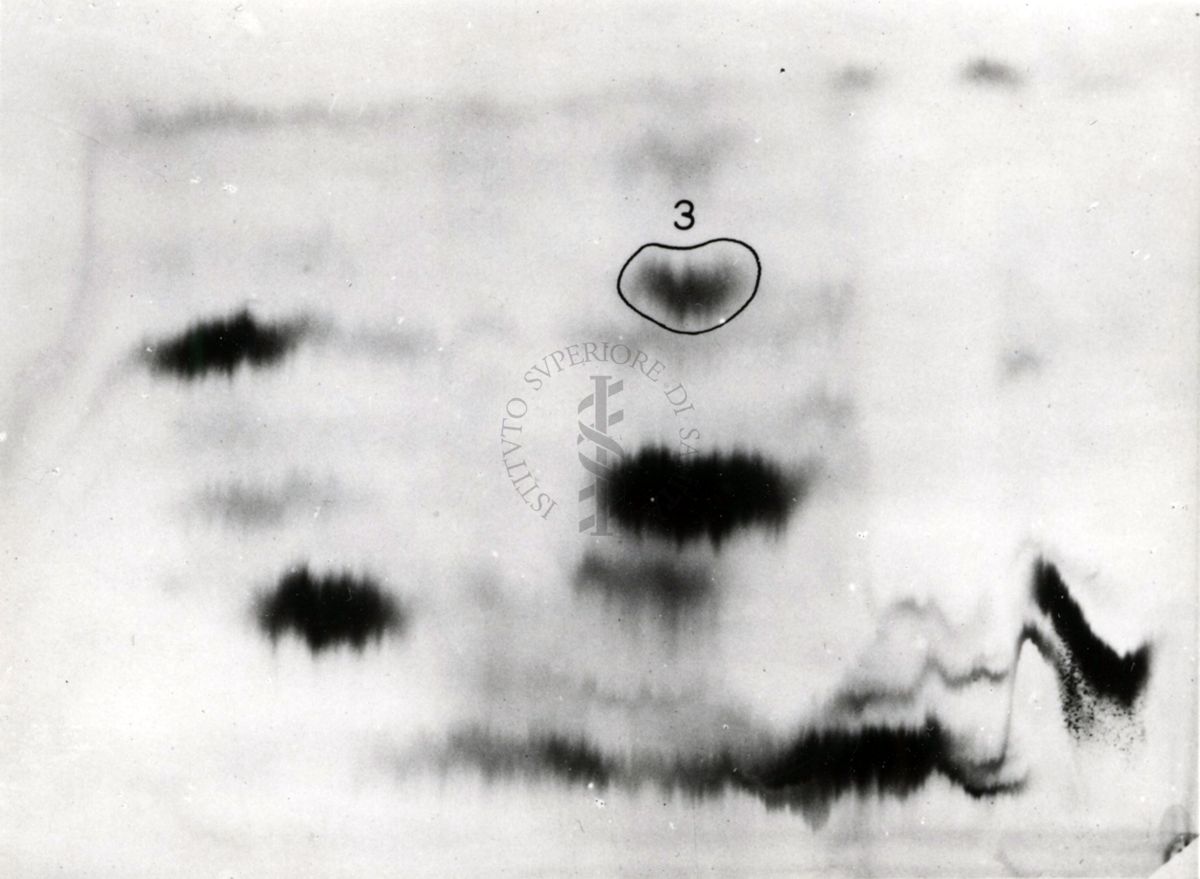 Metabolismo della cistina S.35 nel ratto