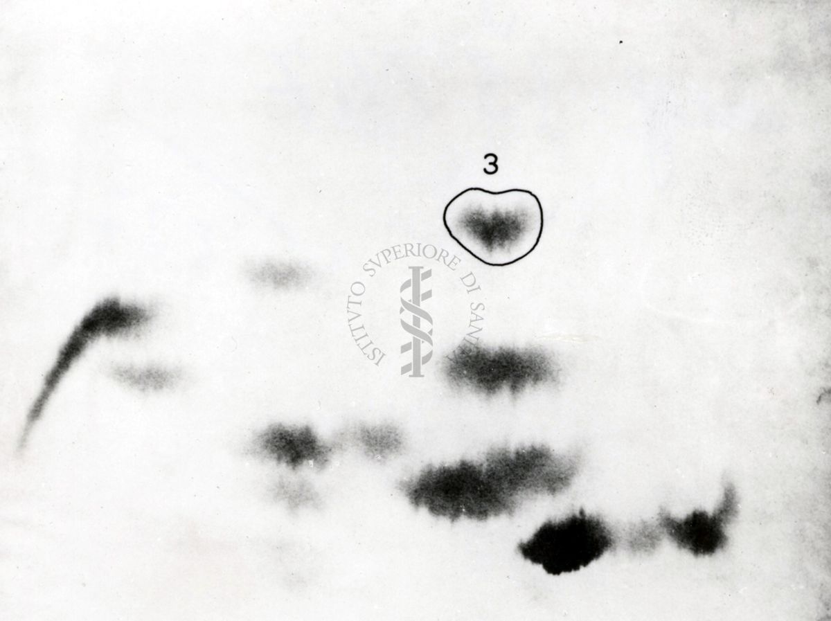 Metabolismo della cistina S.35 nel ratto