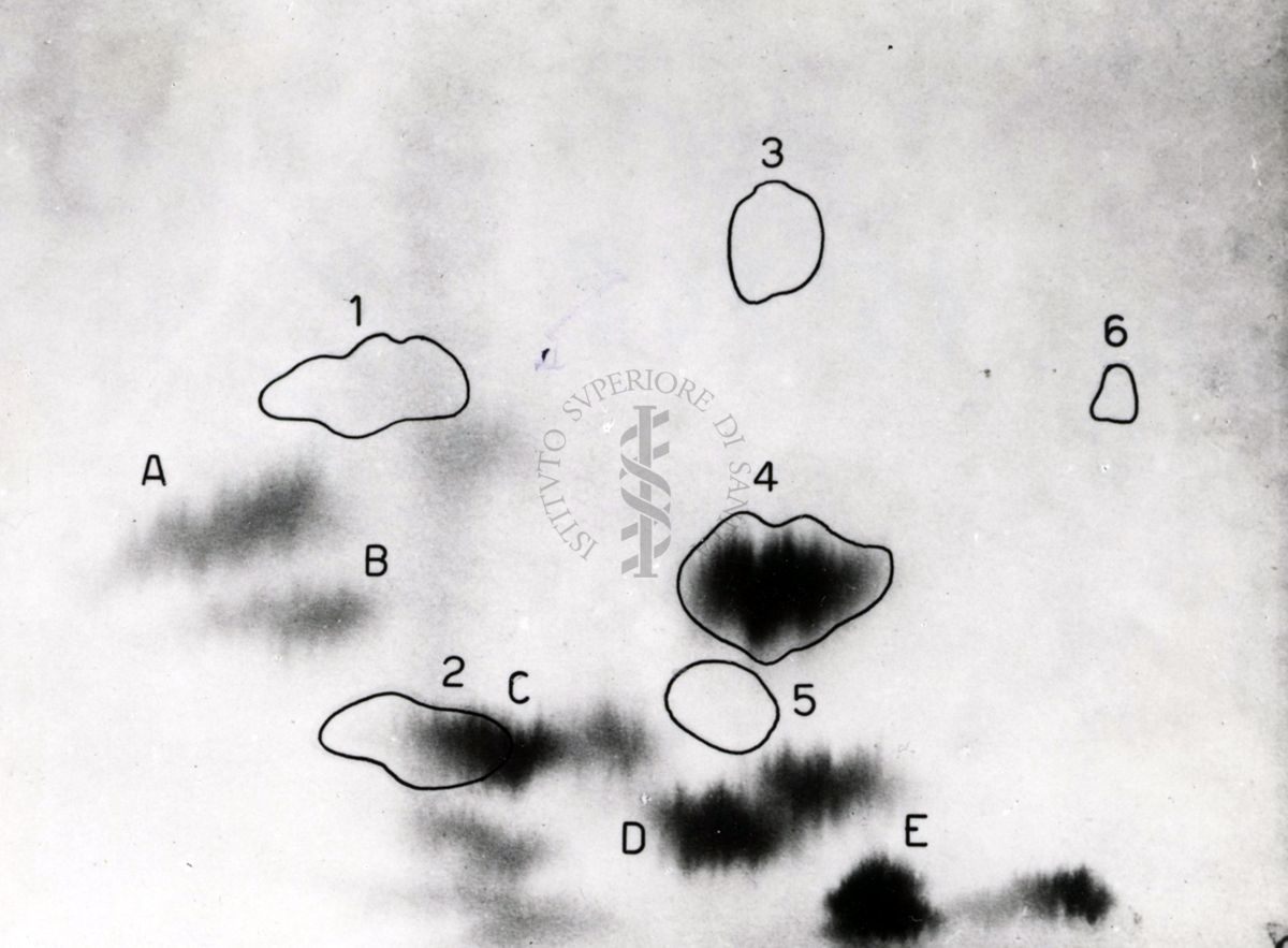 Metabolismo della cistina S.35 nel ratto