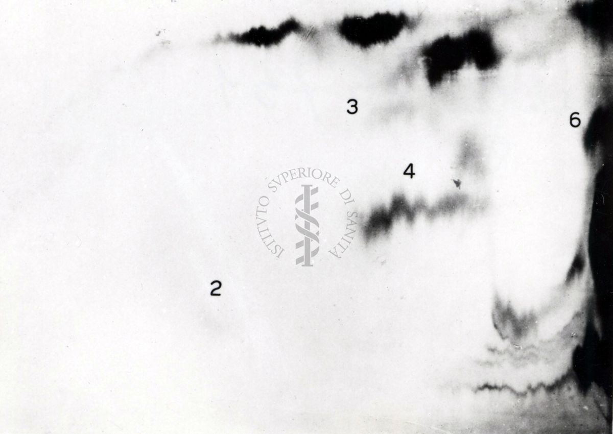 Metabolismo della cistina S.35 nel ratto