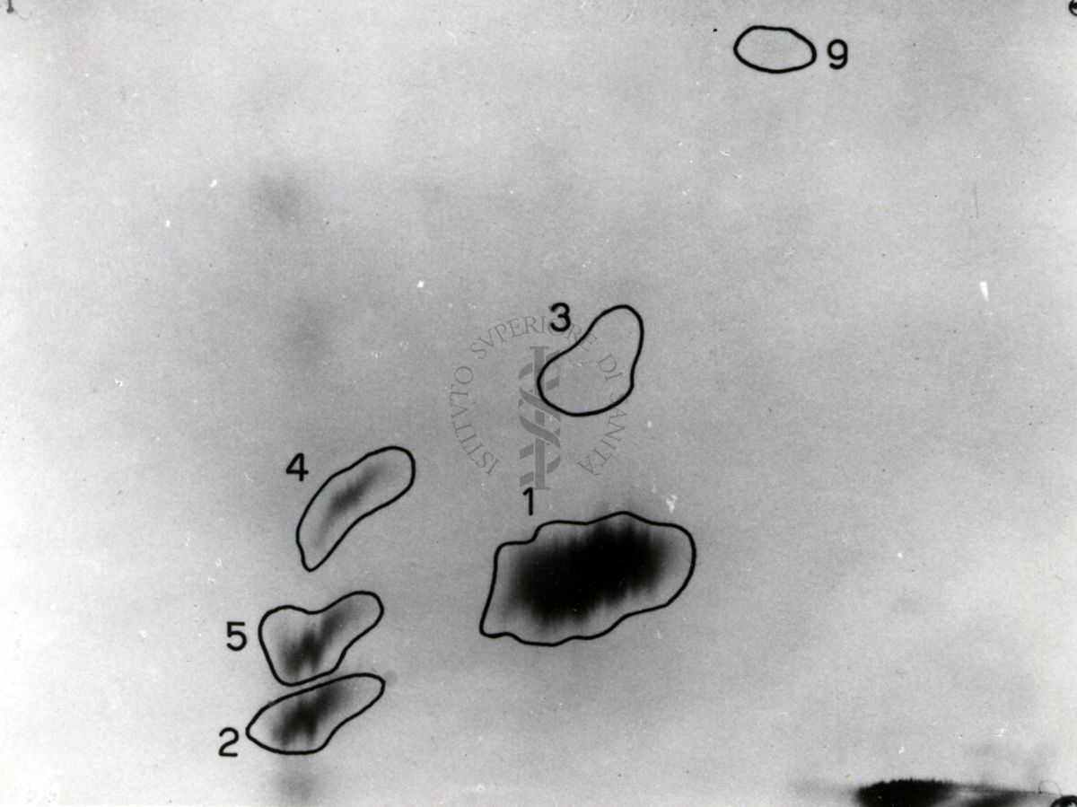 Metabolismo della Licistina S 35 nel ratto (cromatogrammi e auto-radiogrammi di estratto di rene e di urine)