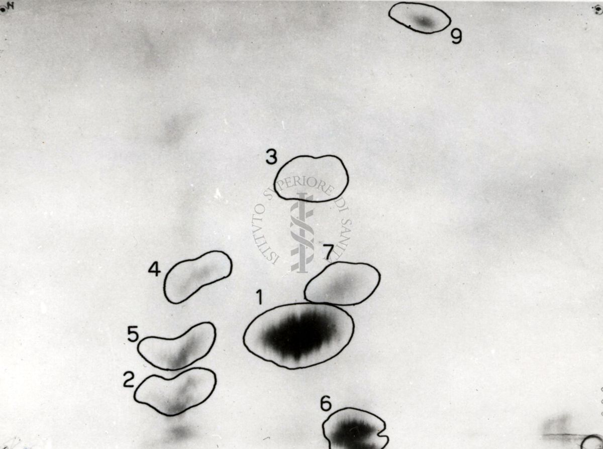 Metabolismo della Licistina S 35 nel ratto (cromatogrammi e auto-radiogrammi di estratto di rene e di urine)