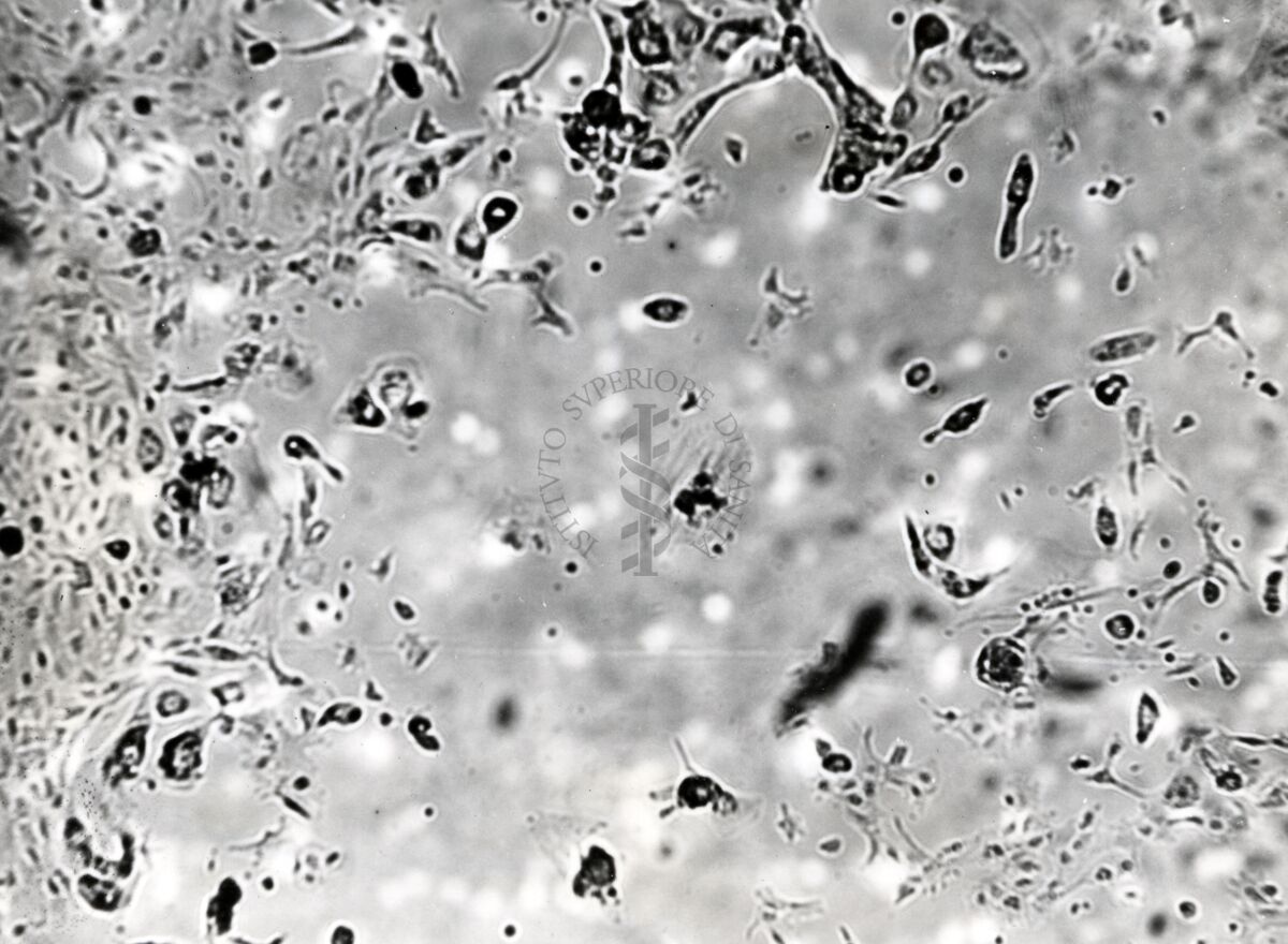 Colture miste di rene di scimmia e carcinoma della mammella di topo C 3 H