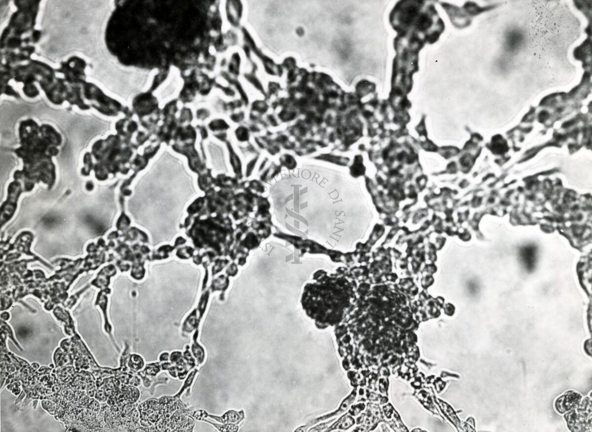 Colture miste di rene di scimmia e carcinoma della mammella di topo C 3 H