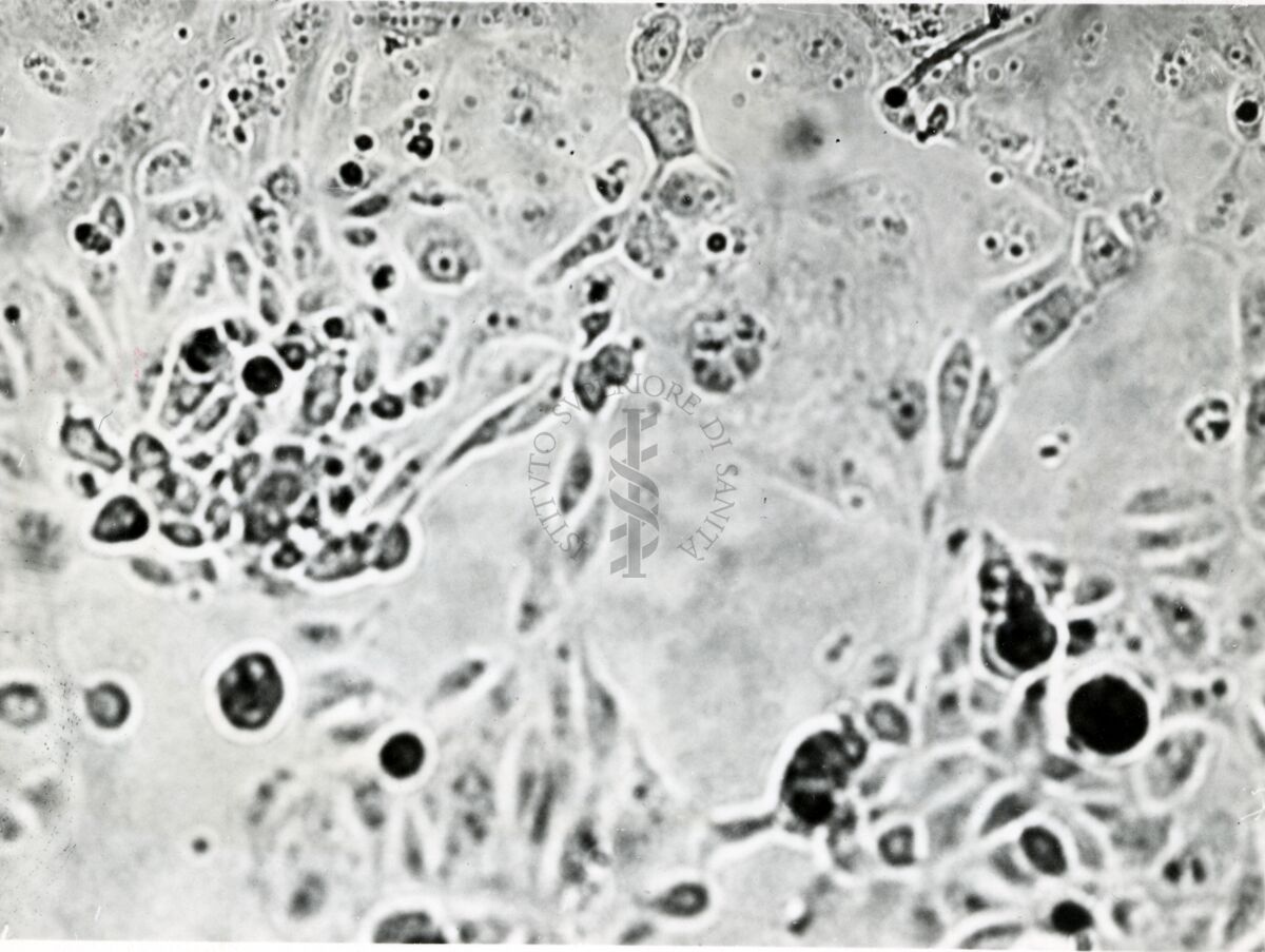 Colture miste di rene di scimmia e carcinoma della mammella di topo C 3 H