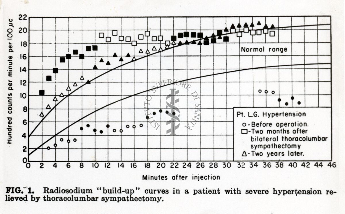 Curve di accumulo di radiosodium in un paziente con ipertensione grave