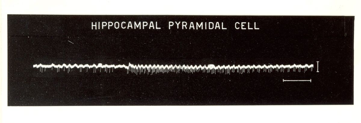 Cellule piramidali dell'ippocampo, tracciato bianco su sfondo nero