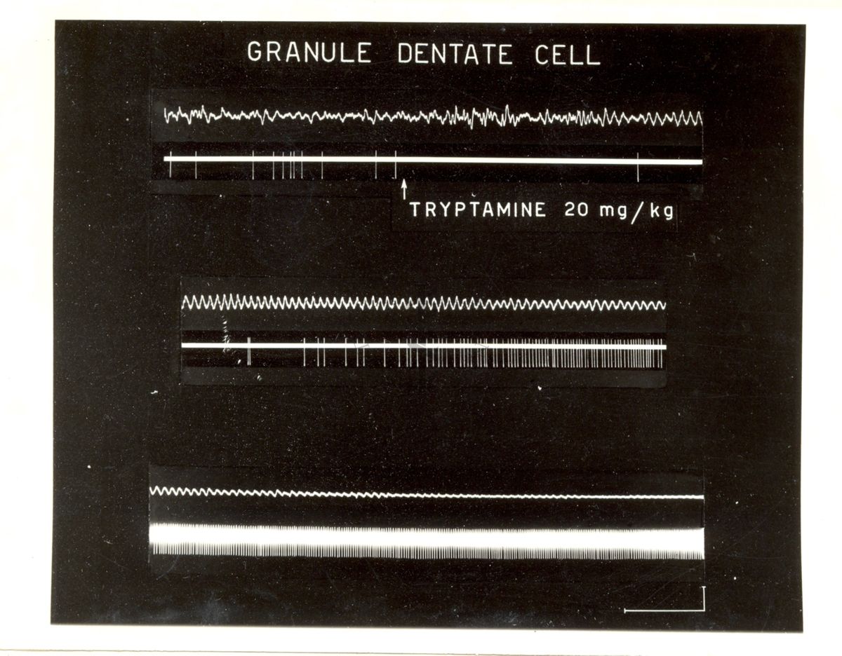 Dentate granular cell: 6 tracciati bianchi su sfondo nero. Sotto il secondo tracciato è scritto: tryptamine 20 mg/kg