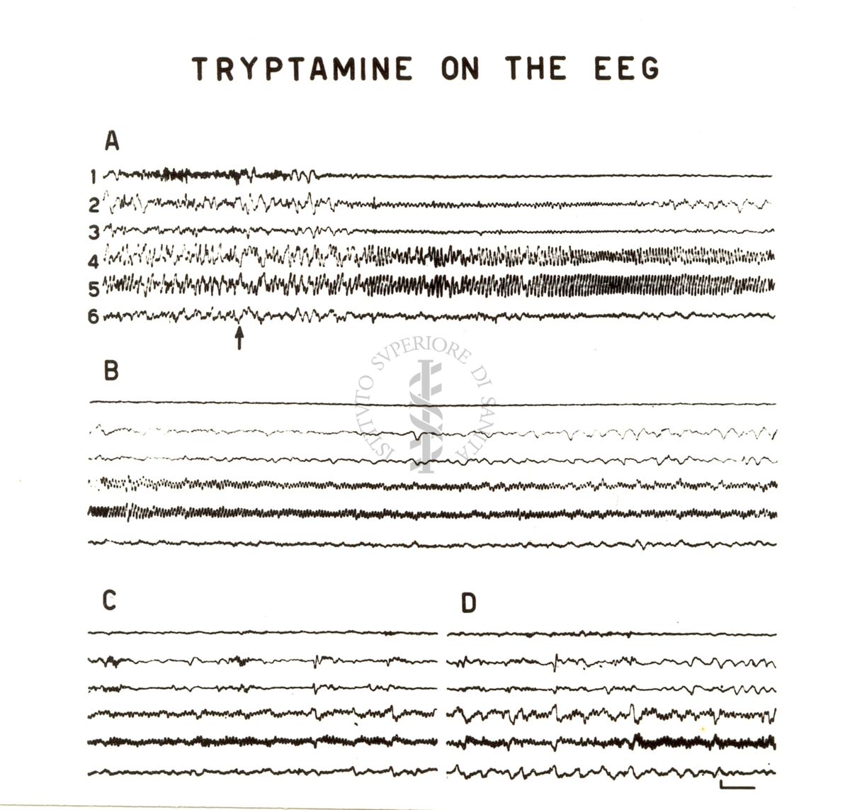 Elettroencefalogramma. Tre gruppi di tracciati su cui è scritto: tryptamine on the EEG