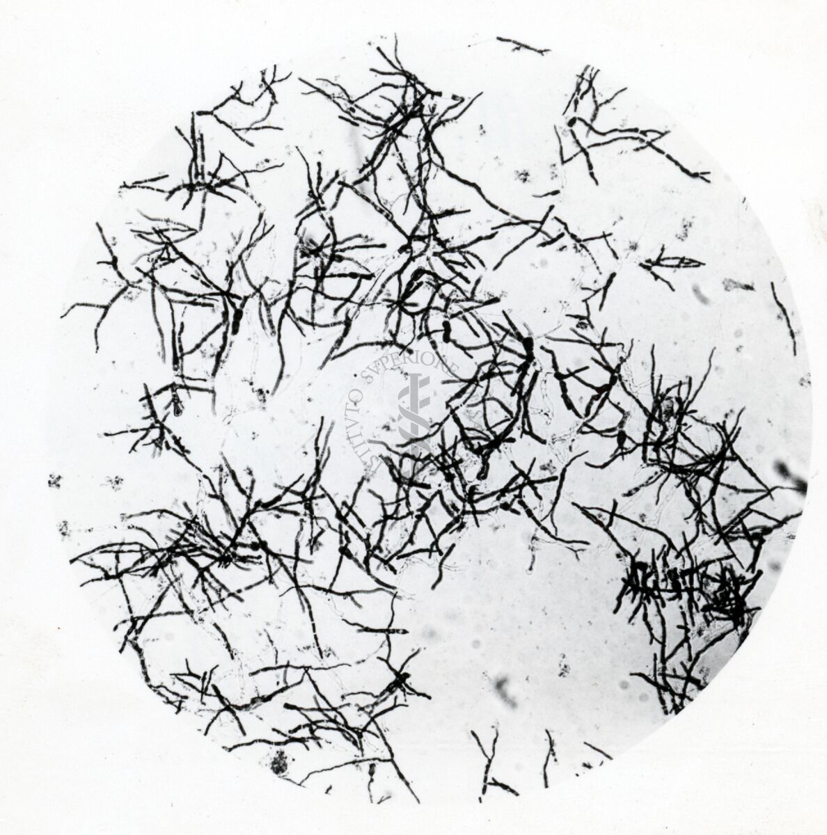 Forme di Penicilium Chrysogenum in coltura sommersa