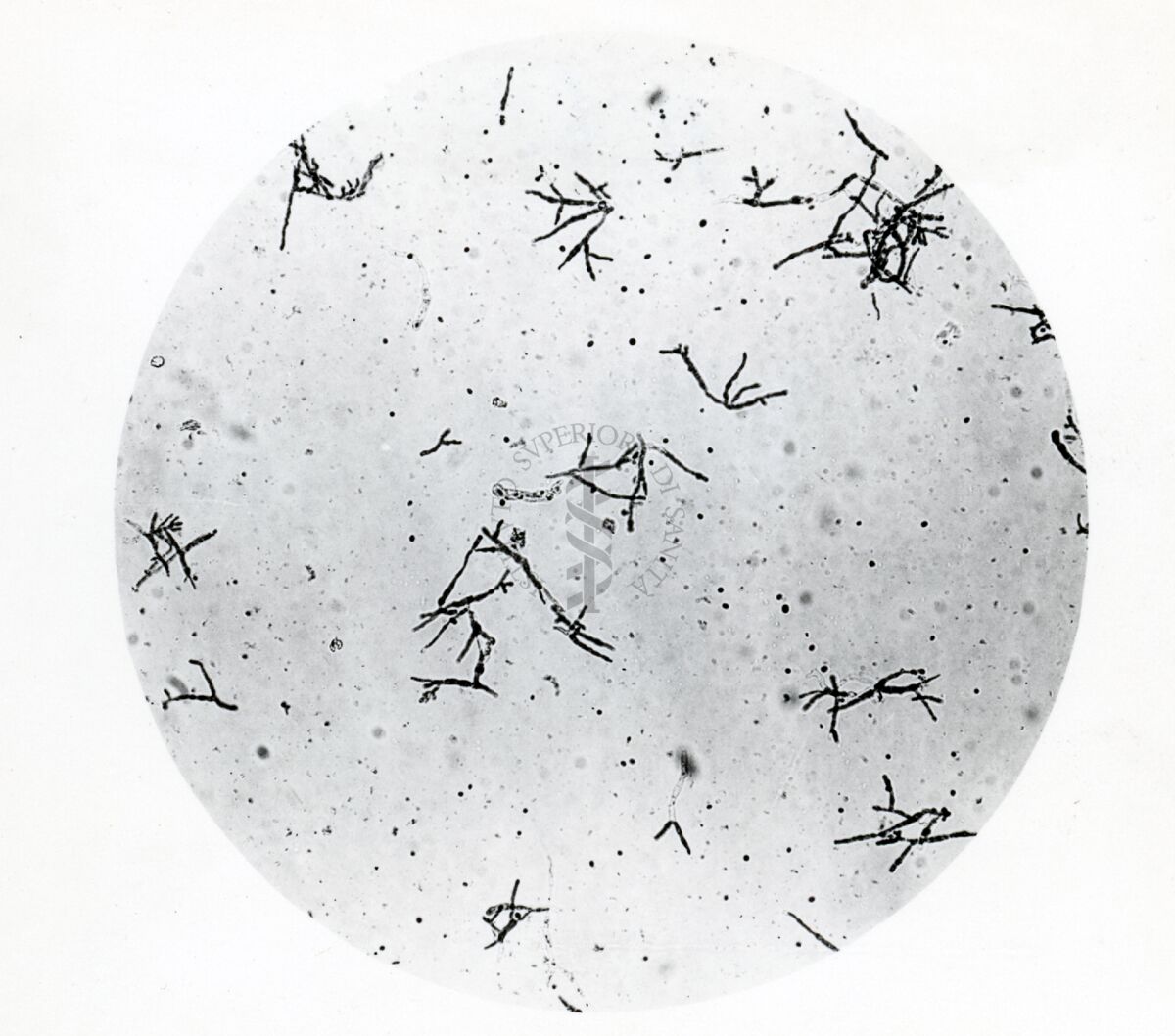 Forme di Penicilium Chrysogenum in coltura sommersa