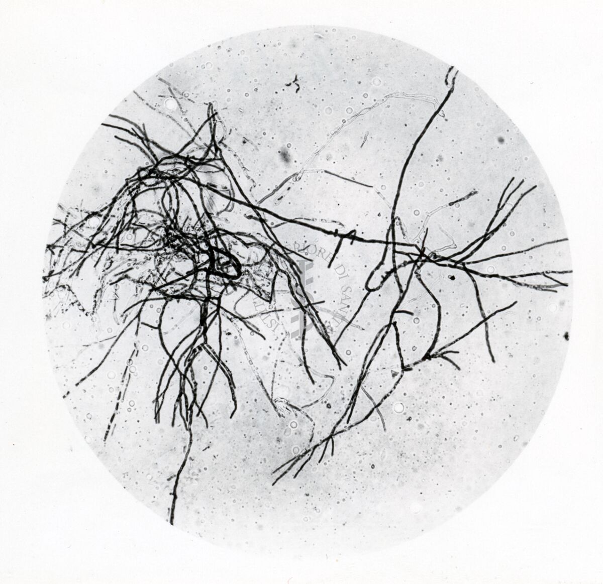 Forme di Penicilium Chrysogenum in coltura sommersa