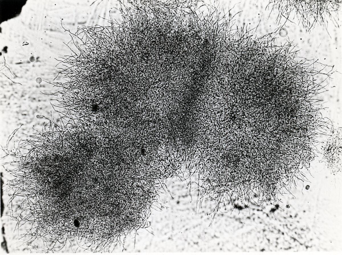 Forme di Penicilium Chrysogenum in coltura sommersa