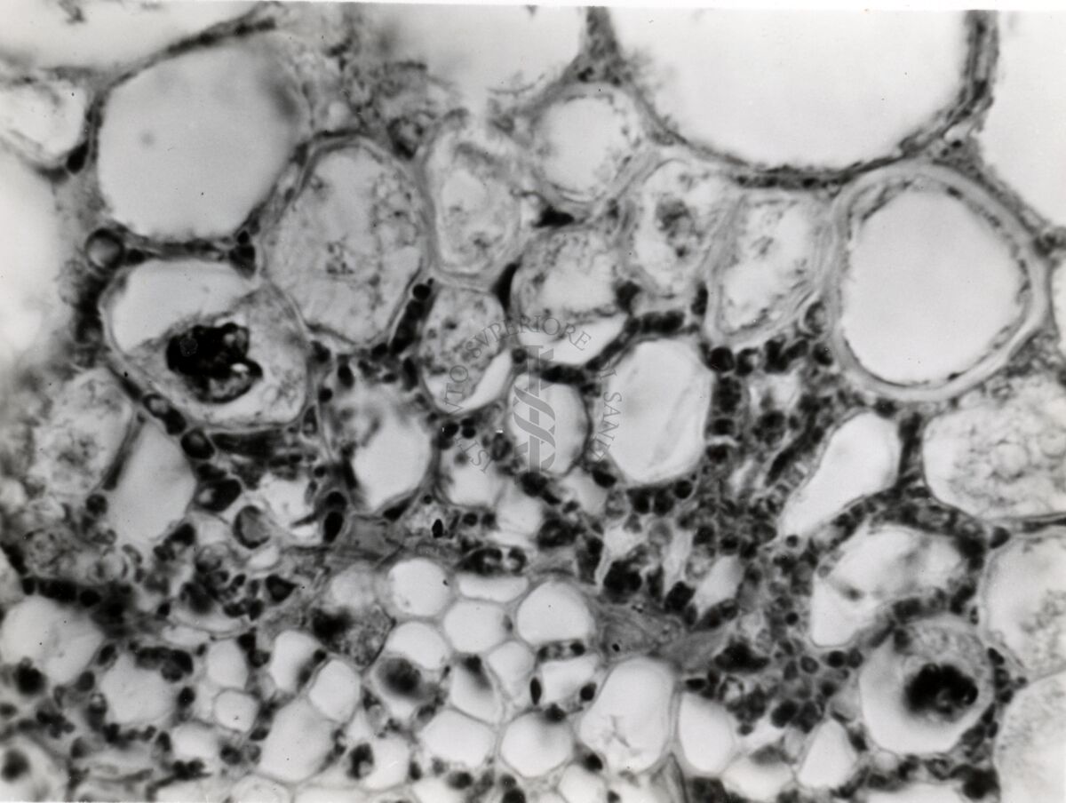 Sezioni di segala infettata da Claviceps