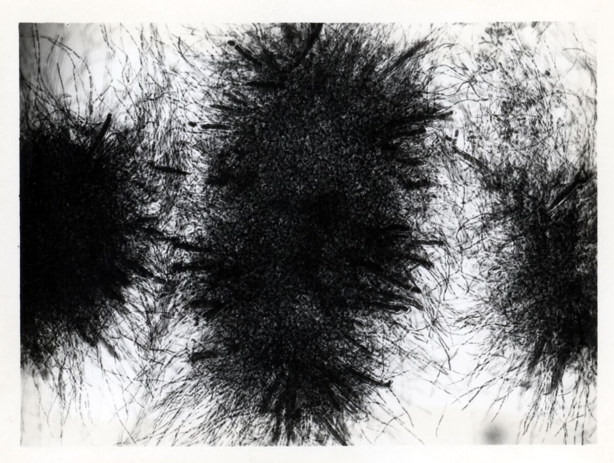 Immagini di Aspergillus Niger in coltura sommersa