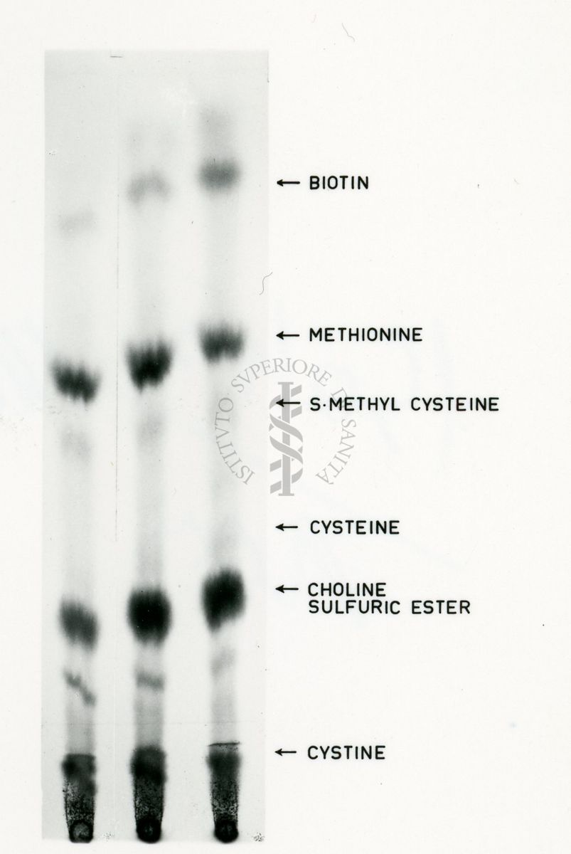 Passi fondamentali del metabolismo dello zolfo nei funghi ed in particolare in Penicillium Shrysogenum