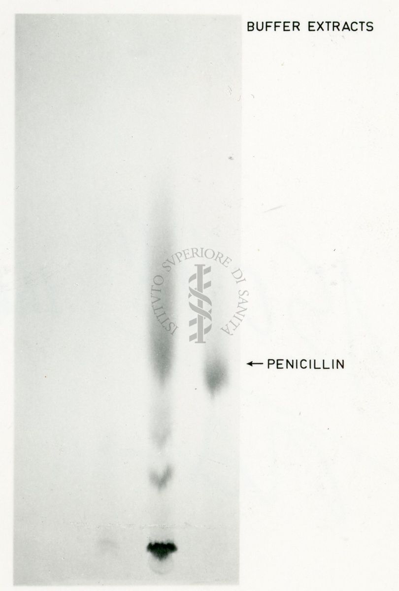 Passi fondamentali del metabolismo dello zolfo nei funghi ed in particolare in Penicillium Shrysogenum