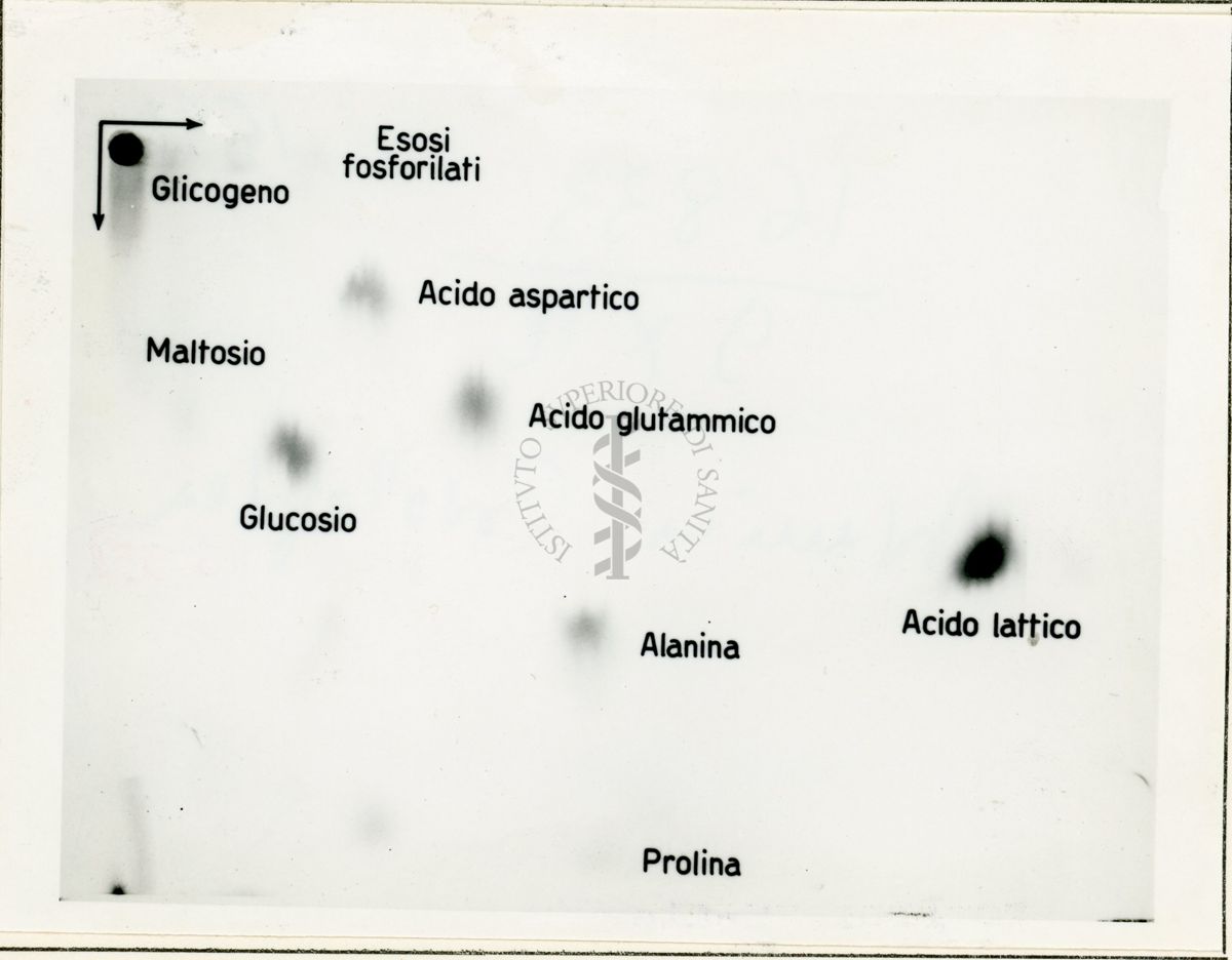 Metabolismo del glucosio 32 P nel diaframma di ratto