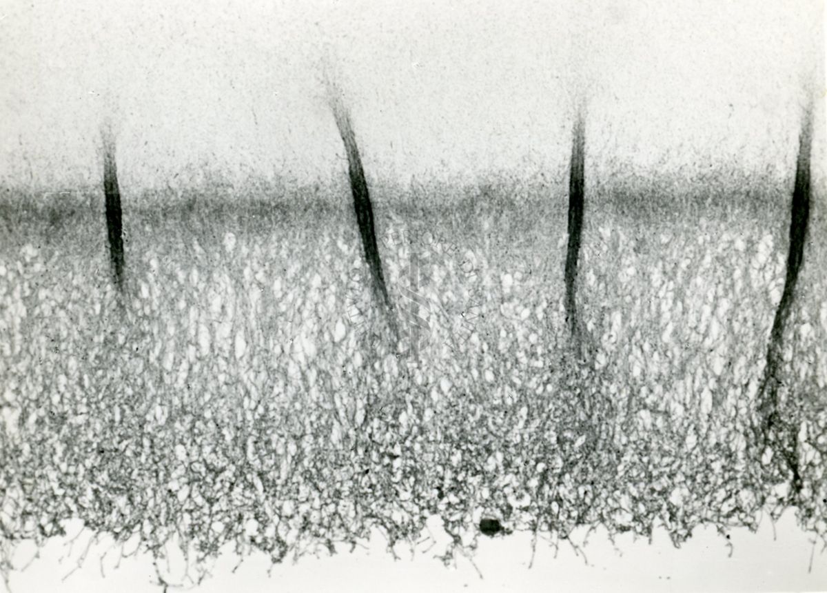 Microfotografia 100 ingrandimenti