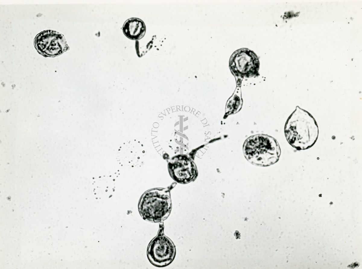 Microfotografia 190 ingrandimenti