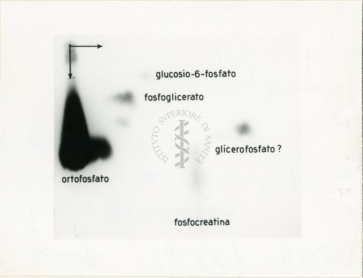 Auto-radiografia di un cromatogramma di un mezzo dopo incubazione di un diaframma di ratto