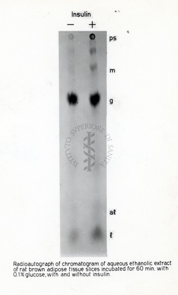 Radiografia - glucosio - adiposo bruno