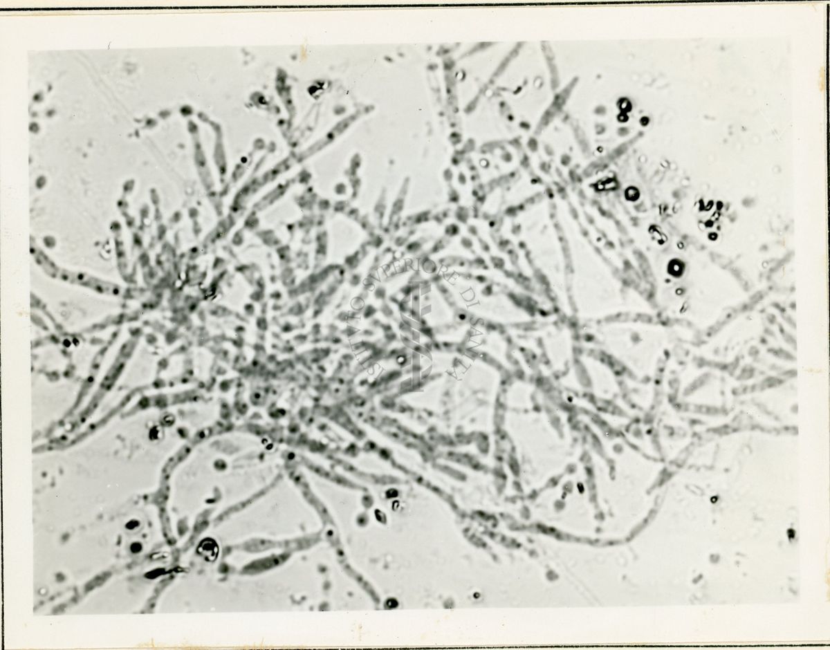 Microfotografia ingrandimenti 1000