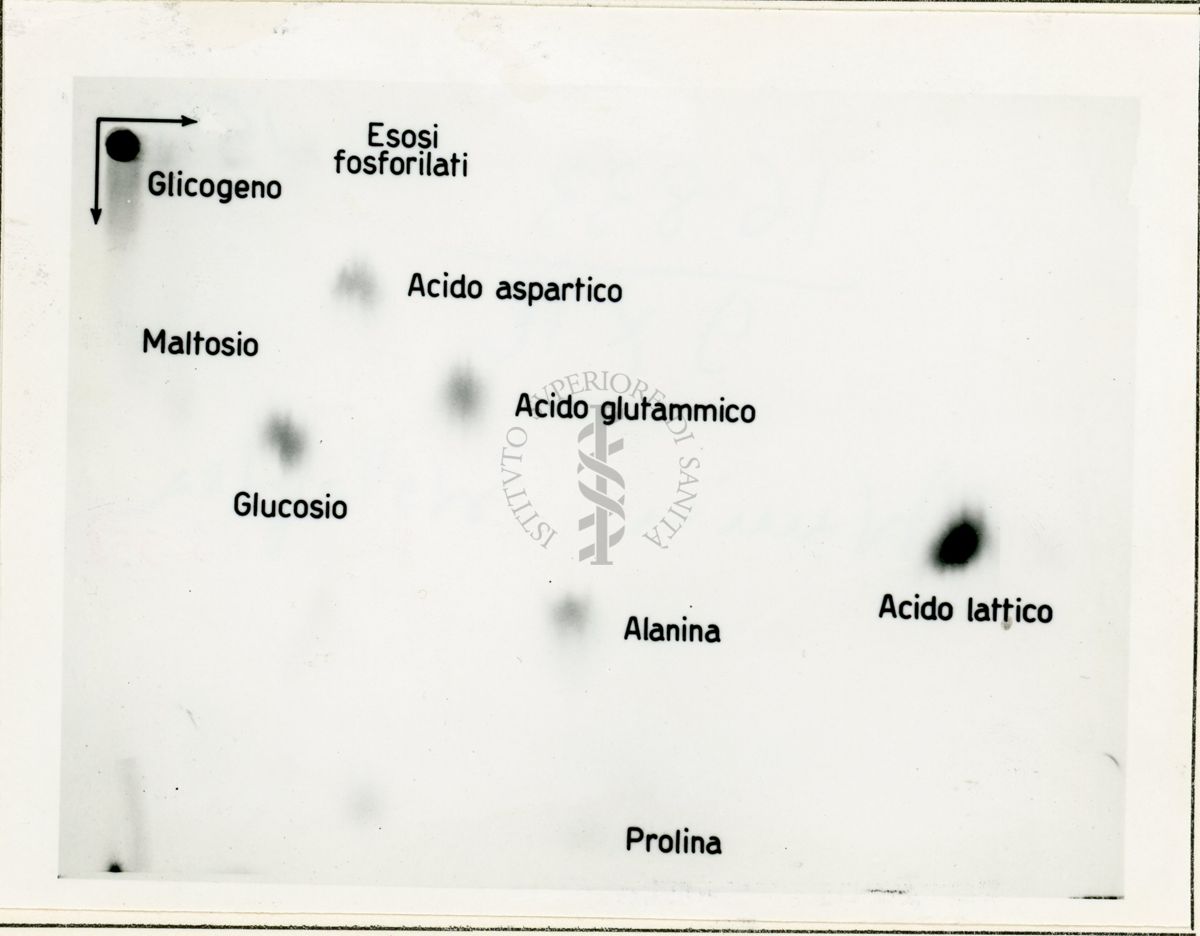 Metabolismo intermedio dei carboidrati