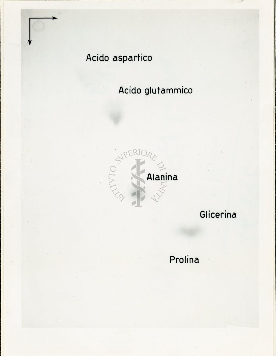 Metabolismo intermedio dei carboidrati